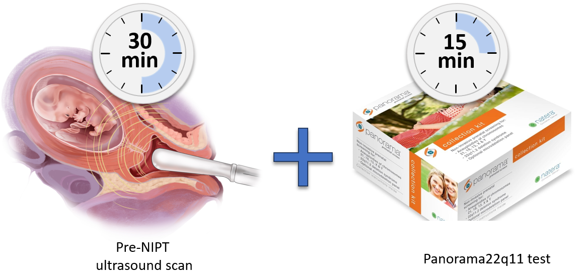 Pre-NIPT with Panorama22q11 test